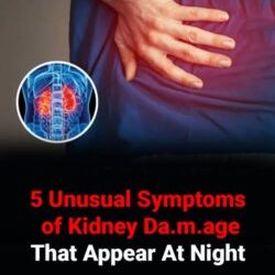 5 Rare Symptoms Pointing to Kidney Damage Night Clues: