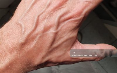 If you have visible veins, it means you are…