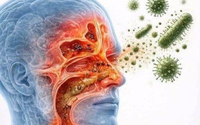 Getting rid of mucus, phlegm in the throat and nose, and rhinitis: home remedies