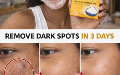 Homemade Baking Soda Cream: Say Goodbye to Wrinkles and Dark Spots