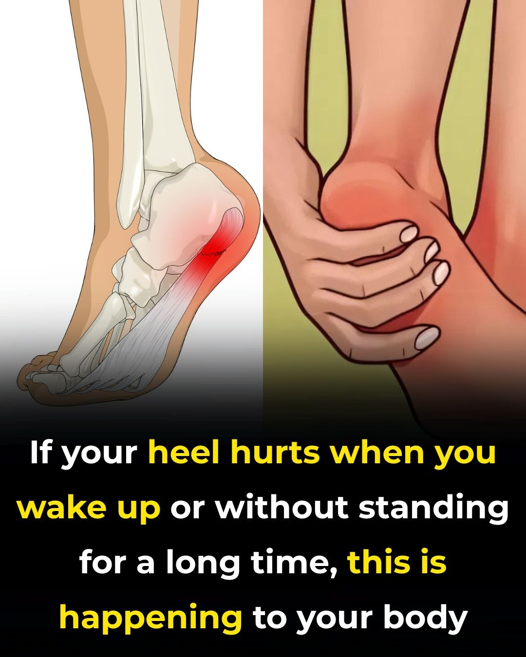 7 Exercises to Help Relieve Heel Discomfort and Support Foot Health